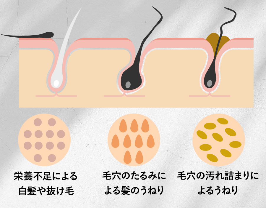 悩める髪と頭皮にWのアプローチ